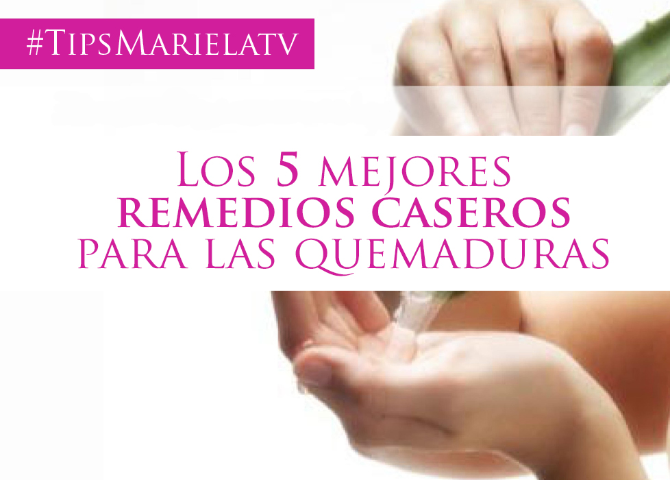 Remedios naturales para quemaduras